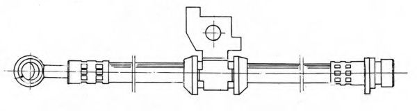 Furtun frana